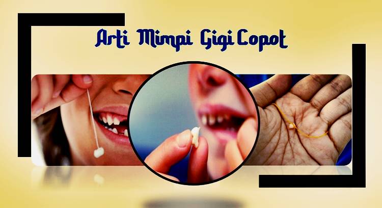 Inilah Arti Mimpi Gigi Copot Bagian Atas Atau Bawah Menurut Ahli Tafsir