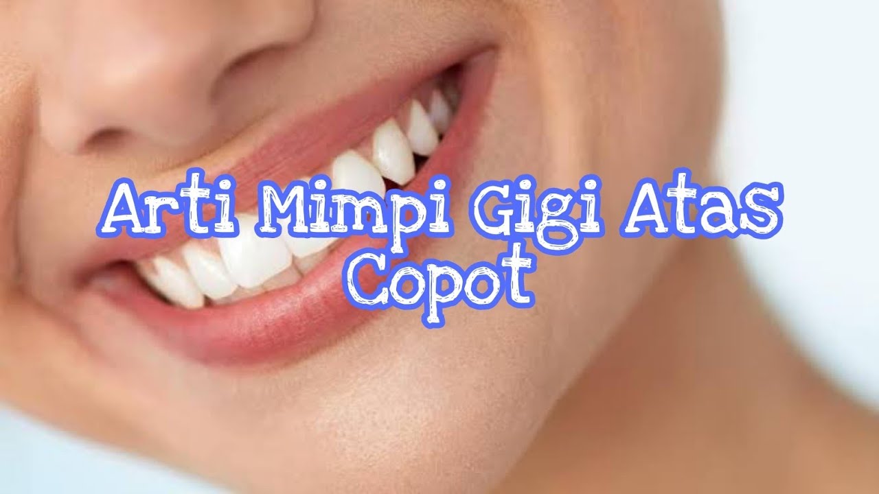 Arti Mimpi Gigi Atas Copot Menurut Islam Primbon Dan Psikologi - YouTube
